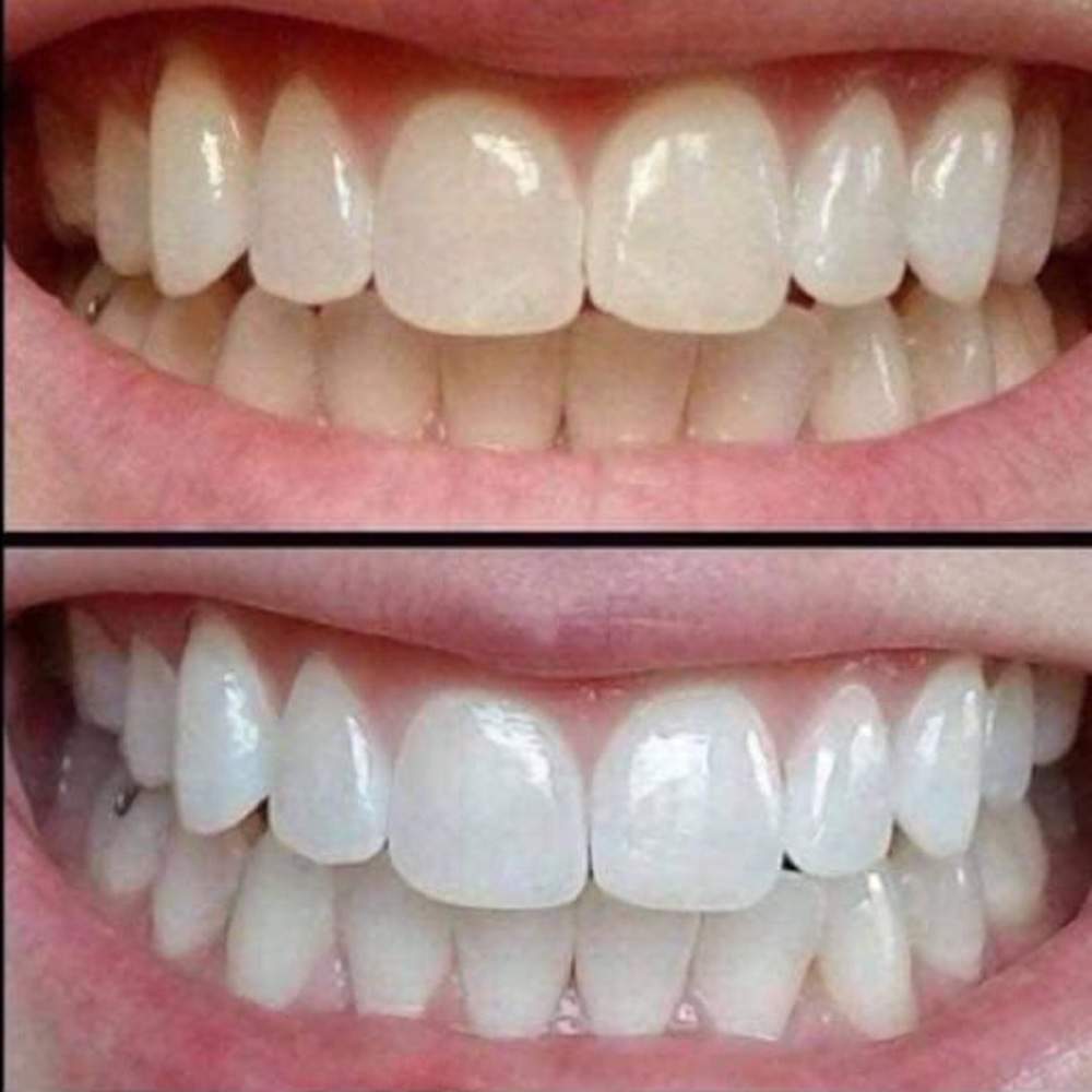 Toothpaste